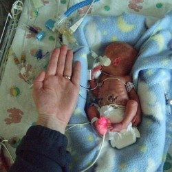 Dexter shortly after he was born... 1 lb, 13.7 oz.